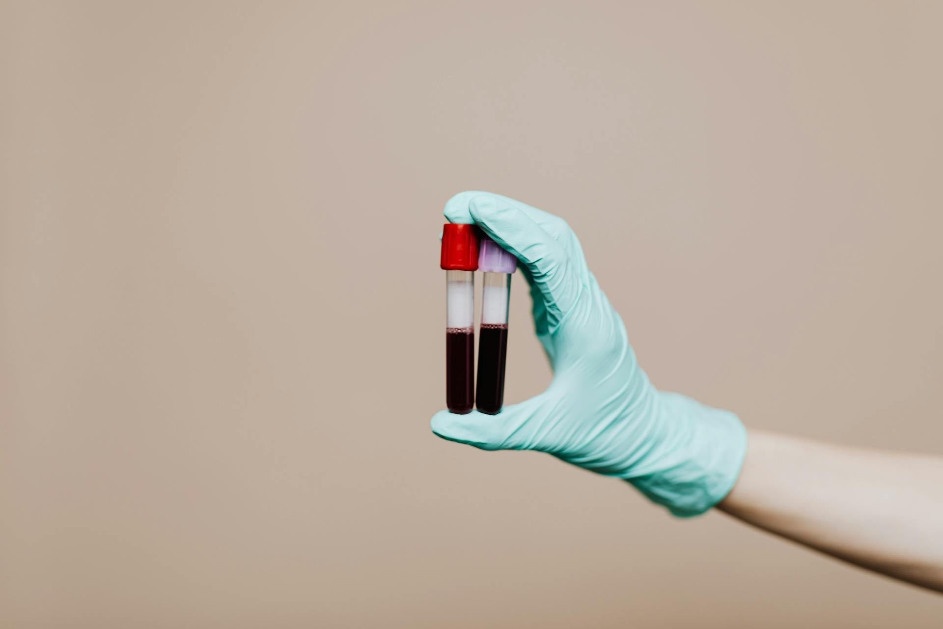 testing blood to see how long do cbd stay in your system